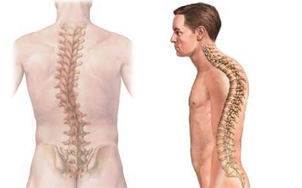 Spinal Deformity Correction